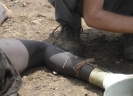 South Sudan Inches Closer to Eradicating Guinea Worm